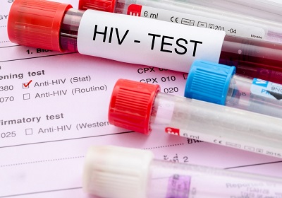 Сочинцы могут анонимно сдать тесты на ВИЧ 